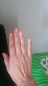 Mão Antes