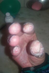 Dedos Antes